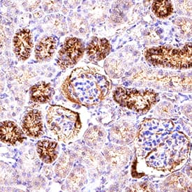 Angiogenin was detected in immersion fixed paraffin-embedded sections of rat kidney using Goat Anti-Human/Rat Angiogenin Antigen Affinity-purified Polyclonal Antibody (Catalog # AF265) at 1 µg/mL for 1 hour at room temperature followed by incubation with the Anti-Goat IgG VisUCyte™ HRP Polymer Antibody (VC004). Before incubation with the primary antibody, tissue was subjected to heat-induced epitope retrieval using Antigen Retrieval Reagent-Basic (CTS013). Tissue was stained using DAB (brown) and counterstained with hematoxylin (blue).  Specific staining was localized to convoluted tubules. Staining was performed using our protocol for IHC Staining with VisUCyte HRP Polymer Detection Reagents.