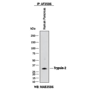 Human Trypsin 2/PRSS2 was immunoprecipitated from 500 μg of human pancreas lysates with 12.5 ug Mouse Anti-Human Trypsin 2/PRSS2 Monoclonal Antibody (Catalog # MAB3586). The Trypsin 2/PRSS2-antibody complexes were absorbed using Protein G Sepharose. Immunoprecipitated human Trypsin 2/PRSS2 was detected by Western blot using 2 µg/mL of Sheep Anti-Human Trypsin Pan Specific (PRSS1/2/3) Antigen Affinity-purified Polyclonal Antibody (AF3586) under non-reducing conditions and using Western Blot Buffer Group 1.