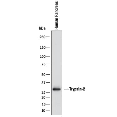 Western blot shows lysates of human pancreas. PVDF membrane was probed with 1 µg/mL of Sheep Anti-Human Trypsin Pan Specific (PRSS1/2/3) Antigen Affinity-purified Polyclonal Antibody (Catalog # AF3586) followed by HRP-conjugated Anti-Sheep IgG Secondary Antibody (HAF016). A specific band was detected for Trypsin at approximately 24 kDa (as indicated). This experiment was conducted under reducing conditions and using Western Blot Buffer Group 1.