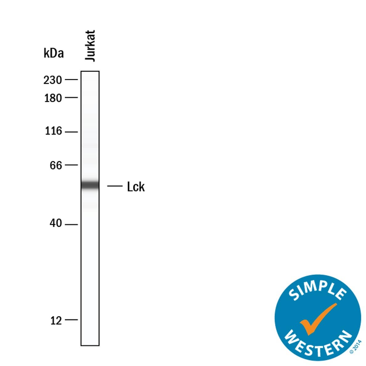 Simple Western lane view shows lysates of Jurkat human acute T cell leukemia cell line, loaded at 0.2 mg/mL. A specific band was detected for Lck at approximately 57 kDa (as indicated) using 5 µg/mL of Goat Anti-Human Lck Antigen Affinity-purified Polyclonal Antibody (Catalog # AF3704) . This experiment was conducted under reducing conditions and using the 12-230kDa separation system.