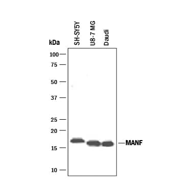 Western blot shows lysates of SH‑SY5Y human neuroblastoma cell line, U‑87 MG human glioblastoma/astrocytoma cell line, and Daudi human Burkitt's lymphoma cell line. PVDF membrane was probed with 1 µg/mL of Goat Anti-Human MANF Antigen Affinity-purified Polyclonal Antibody (Catalog # AF3748) followed by HRP-conjugated Anti-Goat IgG Secondary Antibody (HAF017). A specific band was detected for MANF at approximately 17 kDa (as indicated). This experiment was conducted under reducing conditions and using Western Blot Buffer Group 1.