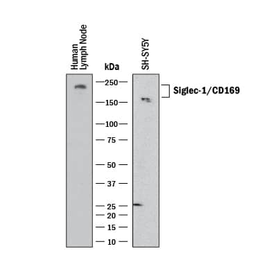 Western blot shows lysates of SH‑SY5Y human neuroblastoma cell line and human lymph node. PVDF membrane was probed with 0.5 µg/mL of Sheep Anti-Human Siglec‑1/CD169 Antigen Affinity-purified Polyclonal Antibody (Catalog # AF5197) followed by HRP-conjugated Anti-Sheep IgG Secondary Antibody (HAF016). A specific band was detected for Siglec‑1/CD169 at approximately 180-200 kDa (as indicated). This experiment was conducted under reducing conditions and using Western Blot Buffer Group 1.