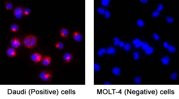 Syntaxin 7 was detected in immersion fixed Daudi Human Burkitt's Lymphoma Cell Line (Positive) and MOLT‑4 Human Acute Lymphoblastic Leukemia Cell Line (Negative) Cells using Sheep Anti-Human/Mouse/Rat Syntaxin 7 Antigen Affinity-purified Polyclonal Antibody (Catalog # AF5478) at 5 µg/mL for 3 hours at room temperature. Cells were stained using the NorthernLights™ 557-conjugated Anti-Goat IgG Secondary Antibody (red; Catalog # NL001) and counterstained with DAPI (blue). Specific staining was localized to cytoplasm. View our protocol for Fluorescent ICC Staining of Non-adherent Cells.