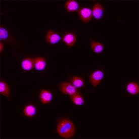 Immunocytochemistry RNF168 Antibody [Unconjugated]