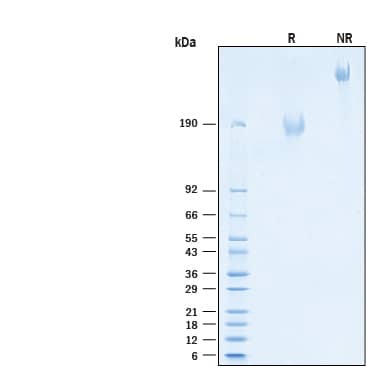 2 μg/lane of Recombinant Human MUC-1 Fc Chimera Alexa Fluor® 488 Protein (Catalog # AFG10332) was resolved with SDS-PAGE under reducing (R) and non-reducing (NR) conditions and visualized by Coomassie® Blue staining, showing bands at 157-192 kDa and 310-380 kDa, respectively.