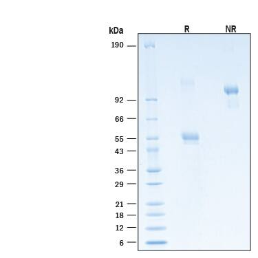 2 μg/lane of Recombinant Human CD300e Fc Chimera Alexa Fluor® 488 Protein (Catalog # AFG10479) was resolved with SDS-PAGE under reducing (R) and non-reducing (NR) conditions and visualized by Coomassie® Blue staining, showing bands at 45-58 kDa and 106-125 kDa (non-reducible dimer), and 90-120 kDa, respectively.