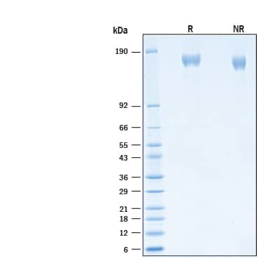 2 μg/lane of Recombinant SARS-CoV-2 B.1.351 Spike (GCN4-IZ) His-tag Alexa Fluor® 488 Protein (Catalog # AFG10786) was resolved with SDS-PAGE under reducing (R) and non-reducing (NR) conditions and visualized by Coomassie® Blue staining, showing bands at 145-168 kDa.