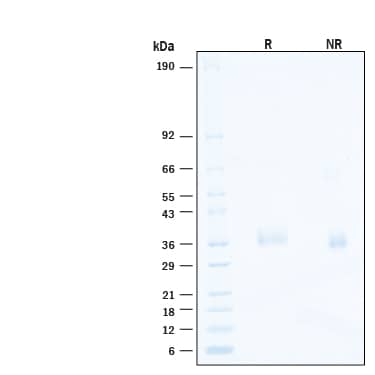 2 μg/lane of Recombinant SARS-CoV-2 B.1.1.529 Spike RBD His-tag Alexa Fluor® 488 Protein (Catalog # AFG11056) was resolved with SDS-PAGE under reducing (R) and non-reducing (NR) conditions and visualized by Coomassie® Blue staining, showing bands at 33-39 kDa.
