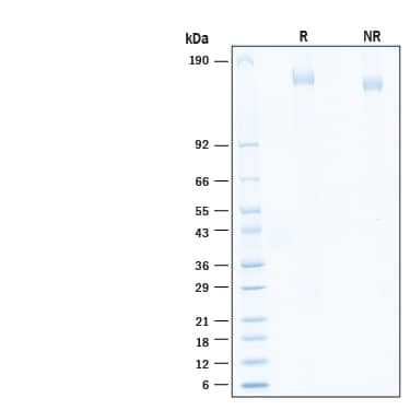 2 μg/lane of Recombinant SARS-CoV-2 B.1.1.529 Spike His-tag Alexa Fluor® 488 Protein (Catalog # AFG11060) was resolved with SDS-PAGE under reducing (R) and non-reducing (NR) conditions and visualized by Coomassie® Blue staining, showing bands at 146-166 kDa.