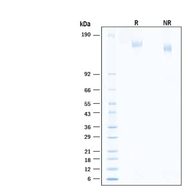 2 μg/lane of Recombinant SARS-CoV-2 B.1.1.529 Spike (GCN4-IZ) His-tag Alexa Fluor® 488 Protein (Catalog # AFG11061) was resolved with SDS-PAGE under reducing (R) and non-reducing (NR) conditions and visualized by Coomassie® Blue staining, showing bands at 145-175 kDa.