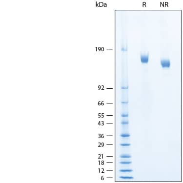 2 μg/lane of Recombinant SARS-CoV-2 BA.4/BA.5 S Alexa Fluor® 488 Protein (Catalog # AFG11231) was resolved with SDS-PAGE under reducing (R) and non-reducing (NR) conditions and visualized by Coomassie® Blue staining, showing bands at 141-170 kDa.