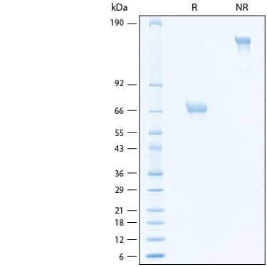 2 μg/lane of Recombinant Human OX40/TNFRSF4 Fc Chimera Alexa Fluor® 488 Protein (Catalog # AFG3388) was resolved with SDS-PAGE under reducing (R) and non-reducing (NR) conditions and visualized by Coomassie® Blue staining, showing bands at 70 kDa and 140 kDa, respectively.