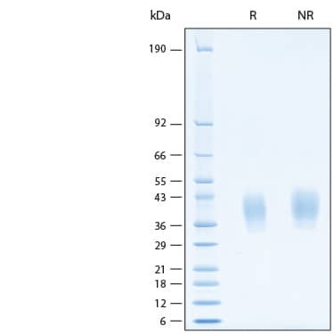 2 μg/lane of Recombinant Human PD-L2/B7-DC His Alexa Fluor® 488 Protein (Catalog # AFG9075) was resolved with SDS-PAGE under reducing (R) and non-reducing (NR) conditions and visualized by Coomassie® Blue staining, showing bands at 29-47 kDa.