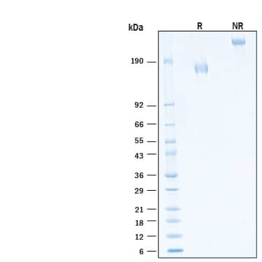 2 μg/lane of Recombinant Human MUC-1 Fc Chimera Alexa Fluor® 647 Protein (Catalog # AFR10332) was resolved with SDS-PAGE under reducing (R) and non-reducing (NR) conditions and visualized by Coomassie® Blue staining, showing bands at 157-192 kDa and 310-380 kDa, respectively.