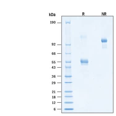 2 μg/lane of Recombinant Human CD300e Fc Chimera Alexa Fluor® 647 Protein (Catalog # AFR10479) was resolved with SDS-PAGE under reducing (R) and non-reducing (NR) conditions and visualized by Coomassie® Blue staining, showing bands at 45-58 kDa and 106-125 kDa (non-reducible dimer), and 90-120 kDa, respectively.