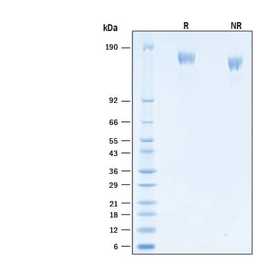 2 μg/lane of Recombinant SARS-CoV-2 B.1.351 Spike (GCN4-IZ) His-tag Alexa Fluor® 647 Protein (Catalog # AFR10786) was resolved with SDS-PAGE under reducing (R) and non-reducing (NR) conditions and visualized by Coomassie® Blue staining, showing bands at 145-168 kDa.