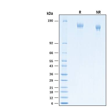 2 μg/lane of Recombinant SARS-CoV-2 P.1 Spike (GCN4-IZ) His-tag Alexa Fluor® 647 Protein (Catalog # AFR10795) was resolved with SDS-PAGE under reducing (R) and non-reducing (NR) conditions and visualized by Coomassie® Blue staining, showing bands at 140-170 kDa.