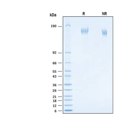 2 μg/lane of Recombinant SARS-CoV-2 S GCN4-IZ Alexa Fluor® 647 Protein (Catalog # AFR10796) was resolved with SDS-PAGE under reducing (R) and non-reducing (NR) conditions and visualized by Coomassie® Blue staining, showing bands at 140-170 kDa.