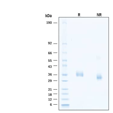 2 μg/lane of Recombinant SARS-CoV-2 B.1.1.529 Spike RBD His-tag Alexa Fluor® 647 Protein (Catalog # AFR11056) was resolved with SDS-PAGE under reducing (R) and non-reducing (NR) conditions and visualized by Coomassie® Blue staining, showing bands at 33-39 kDa.