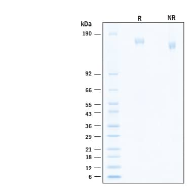 2 μg/lane of Recombinant SARS-CoV-2 B.1.1.529 Spike His-tag Alexa Fluor® 647 Protein (Catalog # AFR11060) was resolved with SDS-PAGE under reducing (R) and non-reducing (NR) conditions and visualized by Coomassie® Blue staining, showing bands at 156-176 kDa.