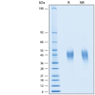 2 μg/lane of Recombinant Human Fc gamma RIIIA Alexa Fluor® 647 Protein (Catalog # AFR4325) was resolved with SDS-PAGE under reducing (R) and non-reducing (NR) conditions and visualized by Coomassie® Blue staining, showing bands at 40-50 kDa.