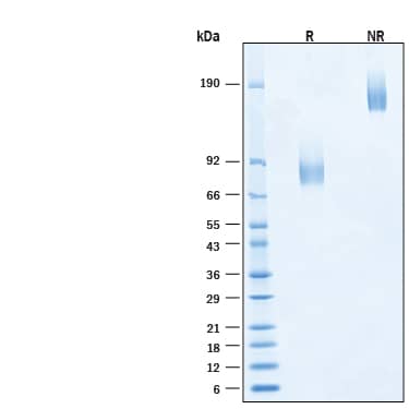 2 μg/lane of Recombinant Human B7‑2/CD86 Fc Chimera Alexa Fluor® 647 Protein (Catalog # AFR7625) was resolved with SDS-PAGE under reducing (R) and non-reducing (NR) conditions and visualized by Coomassie® Blue staining, showing bands at 75-100 kDa and 150-200 kDa, respectively.