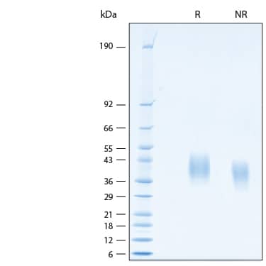 2 μg/lane of Recombinant Human PD-L2/B7-DC His-tag Alexa Fluor® 647 Protein (Catalog # AFR9075) was resolved with SDS-PAGE under reducing (R) and non-reducing (NR) conditions and visualized by Coomassie® Blue staining, showing bands at 29-47 kDa.