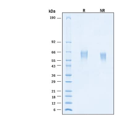 2 μg/lane of Recombinant Human B7‑2/CD86 His-tag Alexa Fluor® 647 Protein (Catalog # AFR9090) was resolved with SDS-PAGE under reducing (R) and non-reducing (NR) conditions and visualized by Coomassie® Blue staining, showing bands at 57-66 kDa.