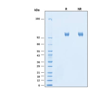 2 μg/lane of Recombinant Human ACE-2 His-tag Alexa Fluor® 647 Protein (Catalog # AFR933) was resolved with SDS-PAGE under reducing (R) and non-reducing (NR) conditions and visualized by Coomassie® Blue staining, showing bands at 101-111 kDa.