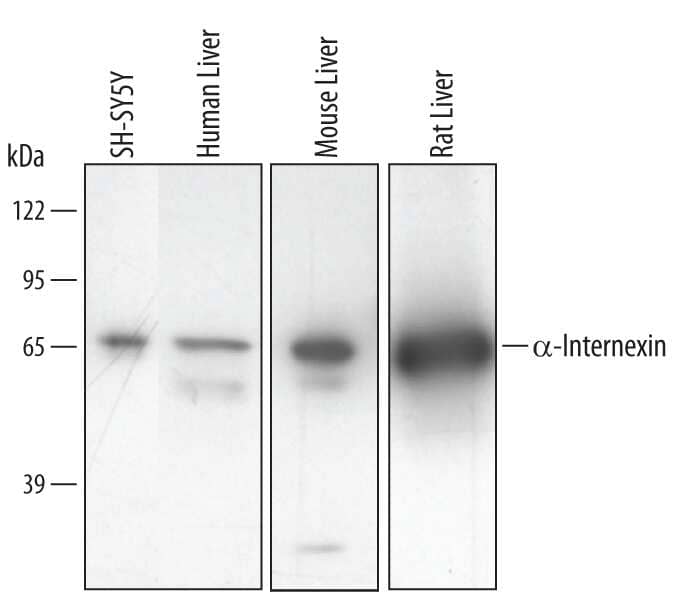 Western blot shows lysates of SH-SY5Y human neuroblastoma cell line, human, mouse, and rat liver tissue. PVDF membrane was probed with 1 µg/mL of Human/Mouse/Rat a-Internexin Antigen Affinity-purified Polyclonal Antibody (Catalog # AF4844) followed by HRP-conjugated Anti-Sheep IgG Secondary Antibody (Catalog # HAF016). A specific band was detected for alpha-Internexin at approximately 66 kDa (as indicated). This experiment was conducted using Immunoblot Buffer Group 2.