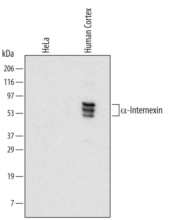 Western blot shows lysates of human cortex tissue. PVDF membrane was probed with 2 µg/mL of Mouse Anti-Human a-Internexin Monoclonal Antibody (Catalog # MAB4844) followed by HRP-conjugated Anti-Mouse IgG Secondary Antibody (Catalog # HAF007). A specific band was detected for a-Internexin at approximately 50-70 kDa (as indicated). This experiment was conducted under reducing conditions and using Immunoblot Buffer Group 1.