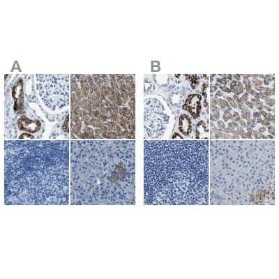 Immunohistochemistry-Paraffin alpha-Methylacyl-CoA Racemase/AMACR Antibody