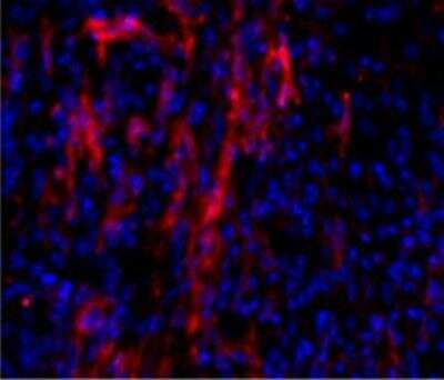 Immunohistochemistry-Frozen: alpha-Smooth Muscle Actin Antibody [NB300-978] - Infarcted mouse heart frozen tissue section immunostained with SMA antibody. IHC-Fr image submitted by a verified customer review.