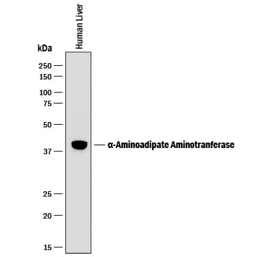 Western blot shows lysates of human liver tissue. PVDF membrane was probed with 1 µg/mL of Sheep Anti-Human a-Aminoadipate Aminotransferase Antigen Affinity-purified Polyclonal Antibody (Catalog # AF7927) followed by HRP-conjugated Anti-Sheep IgG Secondary Antibody (Catalog # HAF016). A specific band was detected for a-Aminoadipate Aminotransferase at approximately 40 kDa (as indicated). This experiment was conducted under reducing conditions and using Immunoblot Buffer Group 1.