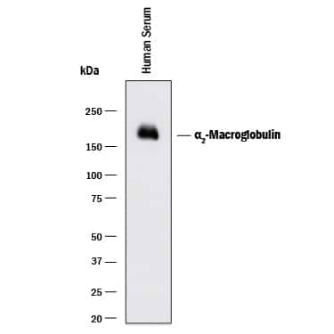     Western  blot shows human serum. PVDF membrane was probed with  2 µg/mL of Mouse Anti-Human   alpha 2‑Macroglobulin Monoclonal Antibody  (Catalog # MAB1938) followed by HRP-conjugated Anti-Mouse IgG Secondary Antibody  (Catalog # HAF018).  A specific band was detected for   alpha 2‑Macroglobulin at approximately 180 kDa  (as indicated). This experiment was conducted under reducing conditions and  using Immunoblot  Buffer Group 1. 