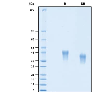 2 μg/lane of Biotinylated Recombinant Human CD25/IL-2R alpha His-tag Avi-tag (Catalog # AVI10305) was resolved with SDS-PAGE under reducing (R) and non-reducing (NR) conditions and visualized by Coomassie® Blue staining, showing bands at 36-51 kDa.