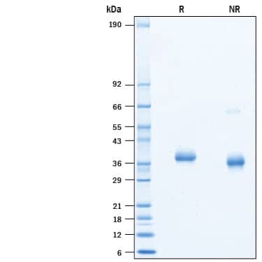 2 μg/lane of Biotinylated Recombinant SARS-CoV-2 Spike RBD His-tag Avi-tag (Catalog # AVI10500) was resolved with SDS-PAGE under reducing (R) and non-reducing (NR) conditions and visualized by Coomassie® Blue staining, showing bands at 34-41 kDa.