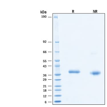 2 μg/lane of Biotinylated Recombinant SARS-CoV-2 B.1.1.7 S RBD Avi-tag Protein (Catalog # AVI10730) was resolved with SDS-PAGE under reducing (R) and non-reducing (NR) conditions and visualized by Coomassie® Blue staining, showing bands at 34-38 kDa.