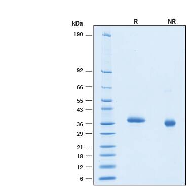 2 μg/lane of Biotinylated Recombinant SARS-CoV-2 B.1.351 Spike RBD His-tag Avitag (Catalog # AVI10735) was resolved with SDS-PAGE under reducing (R) and non-reducing (NR) conditions and visualized by Coomassie® Blue staining, showing bands at 32-38 kDa.