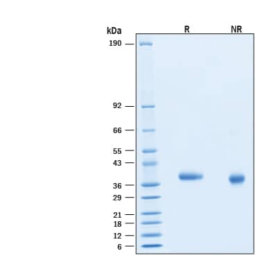 2 μg/lane of Biotinylated Recombinant SARS-CoV-2 P.1 S RBD His-tag Avi-tag Protein  (Catalog # AVI10775) was resolved with SDS-PAGE under reducing (R) and non-reducing (NR) conditions and visualized by Coomassie® Blue staining, showing bands at 32-40 kDa.