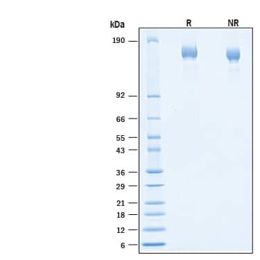 2 μg/lane of Biotinylated Recombinant SARS-CoV-2 P.1 Spike Avi-tag Protein  (Catalog # AVI10795) was resolved with SDS-PAGE under reducing (R) and non-reducing (NR) conditions and visualized by Coomassie® Blue staining, showing bands at 140-170 kDa.