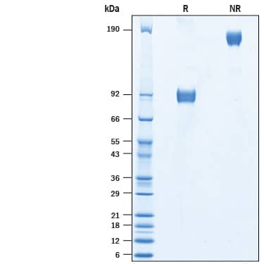 2 μg/lane of Biotinylated Recombinant Human IL-18 R alpha/IL-1 R5 Fc Chimera Avi-tag Protein (Catalog # AVI10841) was resolved with SDS-PAGE under reducing (R) and non-reducing (NR) conditions and visualized by Coomassie® Blue staining, showing bands at 81-97 kDa and 162-194 kDa, respectively.