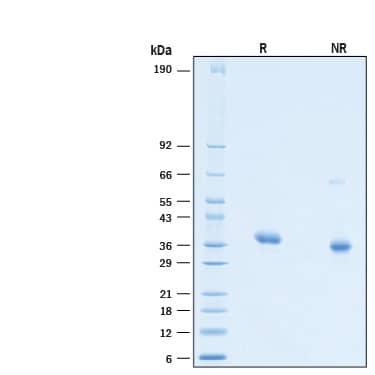 2 μg/lane of Biotinylated Recombinant SARS-CoV-2 B.1.617.1 Spike RBD His-tag Avi-tag Protein (Catalog # AVI10846) was resolved with SDS-PAGE under reducing (R) and non-reducing (NR) conditions and visualized by Coomassie® Blue staining, showing bands at 31-38 kDa.