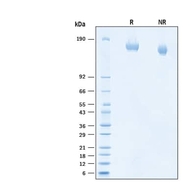 2 μg/lane of Recombinant SARS-CoV-2 B.1.617.1 S (GCN4-IZ) Avi-tag His-tag (Catalog # AVI10861) was resolved with SDS-PAGE under reducing (R) and non-reducing (NR) conditions and visualized by Coomassie® Blue staining, showing bands at 154-170 kDa.