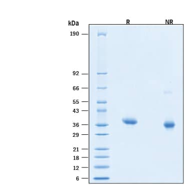 2 μg/lane of Biotinylated Recombinant SARS-CoV-2 B.1.617.2 Spike RBD L452R T478K His-tag Avi-tag Protein (Catalog # AVI10876)  was resolved with SDS-PAGE under reducing (R) andnon-reducing (NR) conditions and visualized by Coomassie® Blue staining, showing bands at 32-40 kDa.