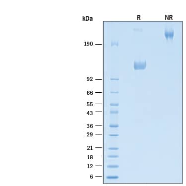 2 μg/lane of Biotinylated Recombinant Human IL-31R Fc Chimera Avi-tag Protein  (Catalog # AVI11028) was resolved with SDS-PAGE under reducing (R) and non-reducing (NR) conditions and visualized by Coomassie® Blue staining, showing bands at 120-145 kDa and 240-290 kDa, respectively.