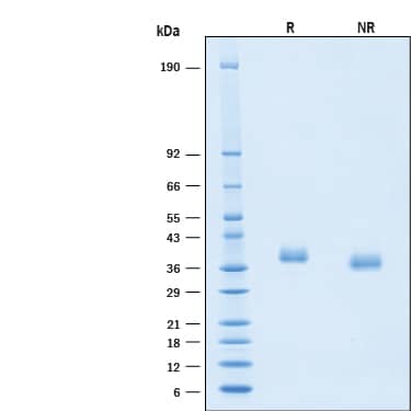 2 μg/lane of Biotinylated Recombinant SARS-CoV-2 B.1.1.529 Spike RBD His-tag Avi-tag Protein (Catalog # AVI11056) was resolved with SDS-PAGE under reducing (R) and non-reducing (NR) conditions and visualized by Coomassie® Blue staining, showing bands at 35-42 kDa.