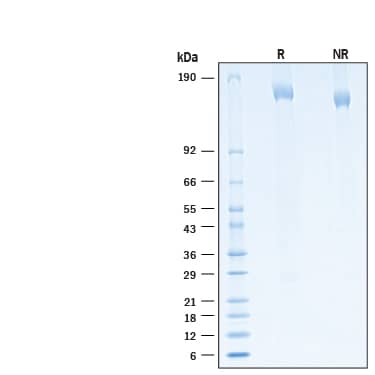 2 μg/lane of Biotinylated Recombinant SARS-CoV-2 B.1.1.529 Spike His-tag Avi-tag Protein (Catalog # AVI11060) was resolved with SDS-PAGE under reducing (R) and non-reducing (NR) conditions and visualized by Coomassie® Blue staining, showing bands at 153 - 170 kDa.