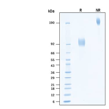 2 μg/lane of Biotinylated Recombinant Human ST2/IL-33R Fc Chimera Avi-tag Protein (Catalog # AVI11066) was resolved with SDS-PAGE under reducing (R) and non-reducing (NR) conditions and visualized by Coomassie® Blue staining, showing bands at 90-105 kDa and 180-210 kDa, respectively.