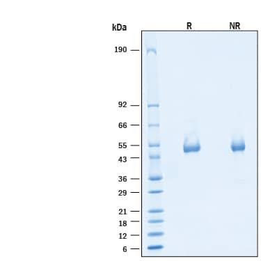 2 μg/lane of Biotinylated Recombinant Human IL-15R alpha His-tag Avi-tag Protein (Catalog # AVI11068) was resolved with SDS-PAGE under reducing (R) and non-reducing (NR) conditions and visualized by Coomassie® Blue staining, showing bands at 45-63 kDa.